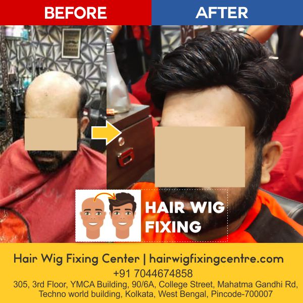 Hair Wig Fixing Centre