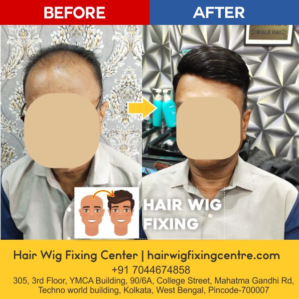 Hair Wig Fixing Centre